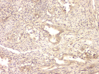 BMP15 Antibody