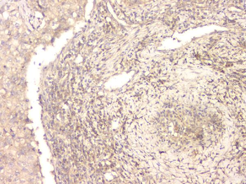 BMP15 Antibody
