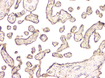 BMP15 Antibody