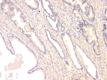 BMP15 Antibody
