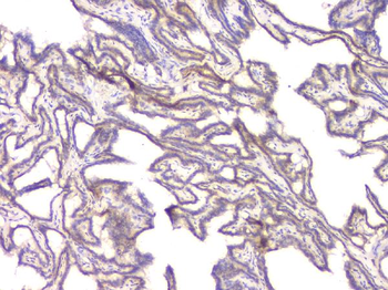 BMP15 Antibody