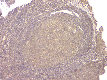 BMP15 Antibody