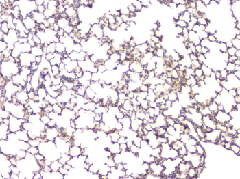 BMP15 Antibody