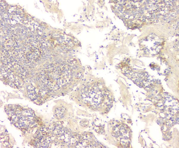 GPR2/CCR10 Rabbit Polyclonal Antibody