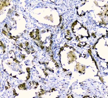 CDA Antibody
