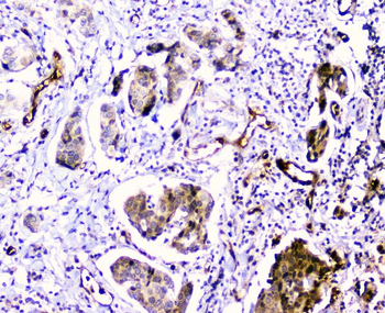 CDA Antibody