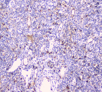 CDA Antibody