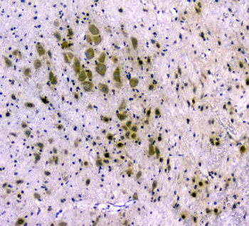 CDA Antibody