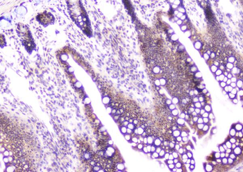 CDA Antibody