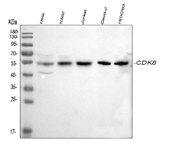 CDK8 Rabbit Polyclonal Antibody