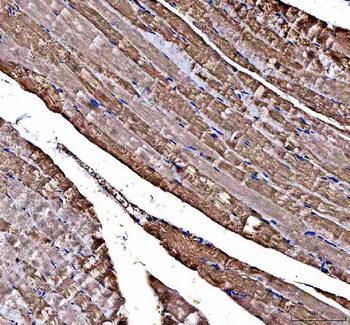 DOK7 Rabbit Polyclonal Antibody