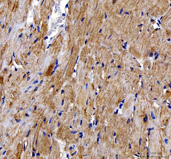 DOK7 Rabbit Polyclonal Antibody