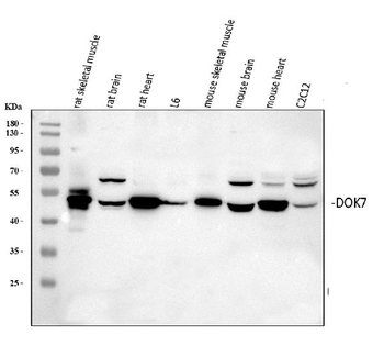 DOK7 Rabbit Polyclonal Antibody