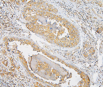 IQGAP1 Rabbit Polyclonal Antibody