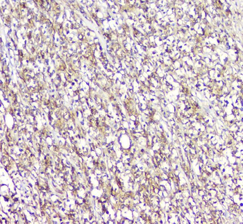 Plastin L/LCP1 Antibody