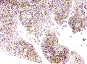 Plastin L/LCP1 Antibody