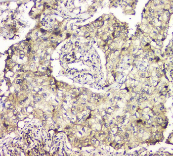 MCUR1 Rabbit Polyclonal Antibody