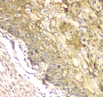 MCUR1 Rabbit Polyclonal Antibody
