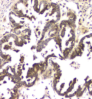 MCUR1 Rabbit Polyclonal Antibody