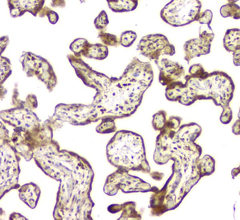 MCUR1 Rabbit Polyclonal Antibody