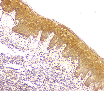 MCUR1 Rabbit Polyclonal Antibody