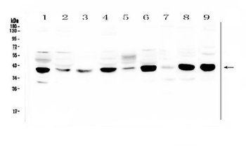 MCUR1 Rabbit Polyclonal Antibody
