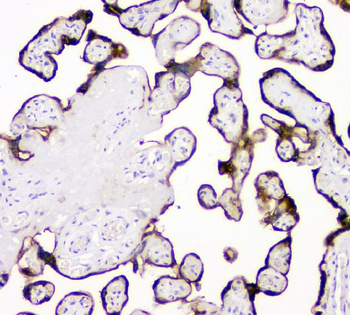TPA Tissue Plasminogen Activator/PLAT Rabbit Polyclonal Antibody