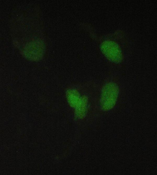 PPCS Rabbit Polyclonal Antibody