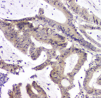 PPCS Rabbit Polyclonal Antibody