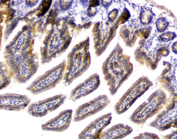 PPCS Rabbit Polyclonal Antibody