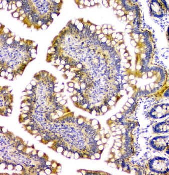 PPCS Rabbit Polyclonal Antibody