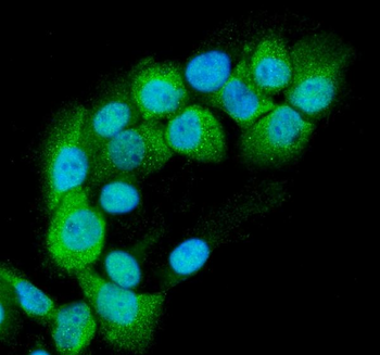 RAB11B Antibody