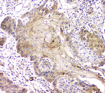 RAB11B Antibody