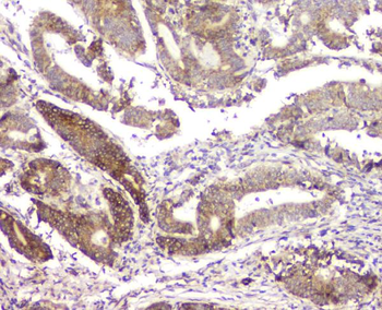 RMI2 Antibody