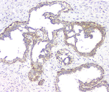 RMI2 Antibody