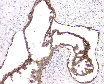 RMI2 Antibody