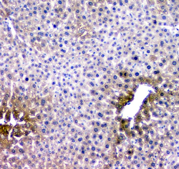 RMI2 Antibody