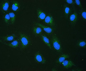 RRBP1 Antibody