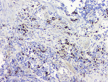RRBP1 Antibody