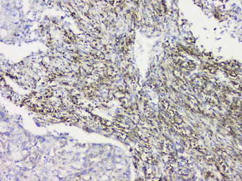 RRBP1 Antibody