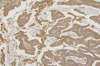 SFRP1 Antibody