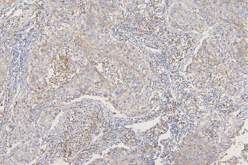 SFRP1 Antibody