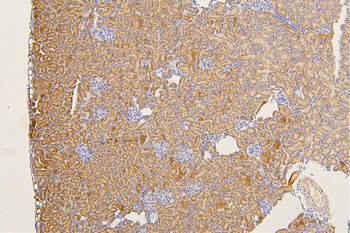 SFRP1 Antibody