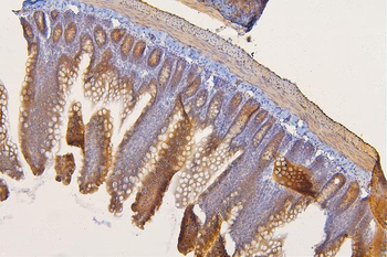 SFRP1 Antibody