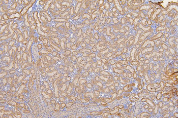 SFRP1 Antibody