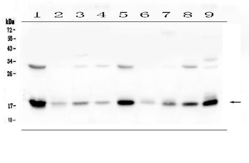 TIMM17A Antibody