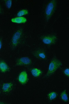 TIMM17A Antibody