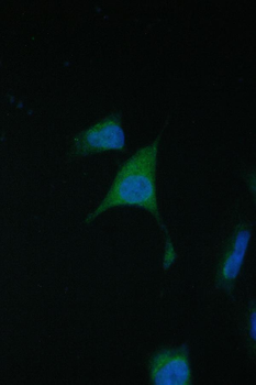 TIMM17A Antibody