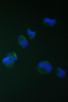 TIMM17A Antibody
