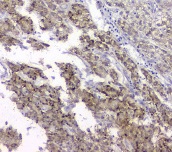 TIMM17A Antibody